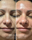 Skin Revive