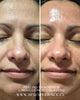 Skin Revive