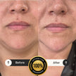 Tratamiento Facial: Reafirmante Intensivo Radiance Lift - Oferta Aniversario 🥳🎂 - Spa Experience Antofagasta