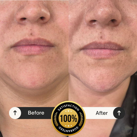 Tratamiento Facial: Reafirmante Intensivo Radiance Lift - Oferta Aniversario 🥳🎂 - Spa Experience Antofagasta