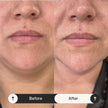 Tratamiento Facial: Reafirmante Intensivo Radiance Lift