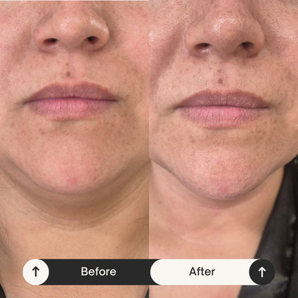 Tratamiento Facial: Reafirmante Intensivo Radiance Lift