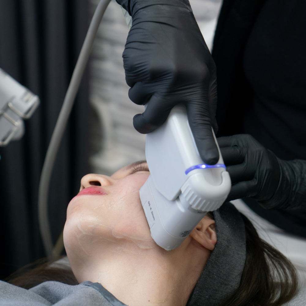 Tratamiento Reafirmante HIFU 7D Facial: Tecnología Avanzada para Piel ...